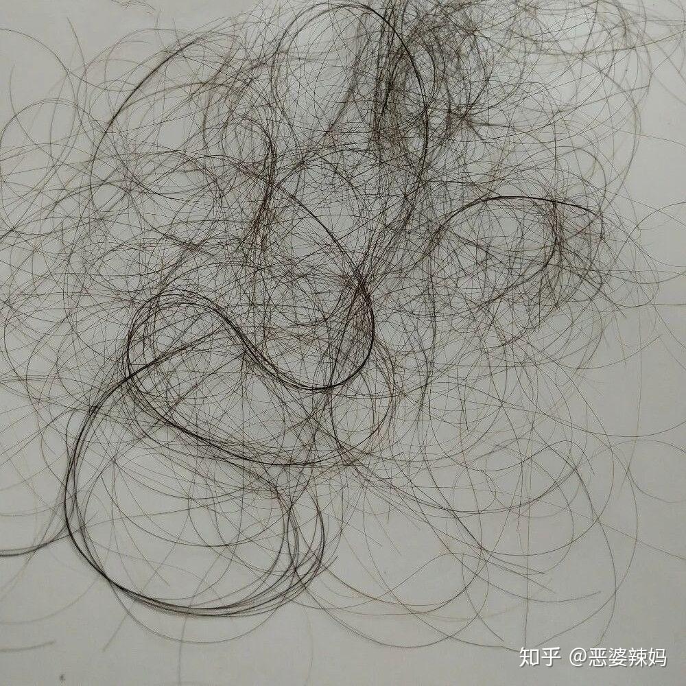 如何使发量变多？ - 知乎