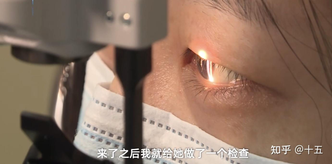 女生养宠物致睫毛滋生上千只螨虫