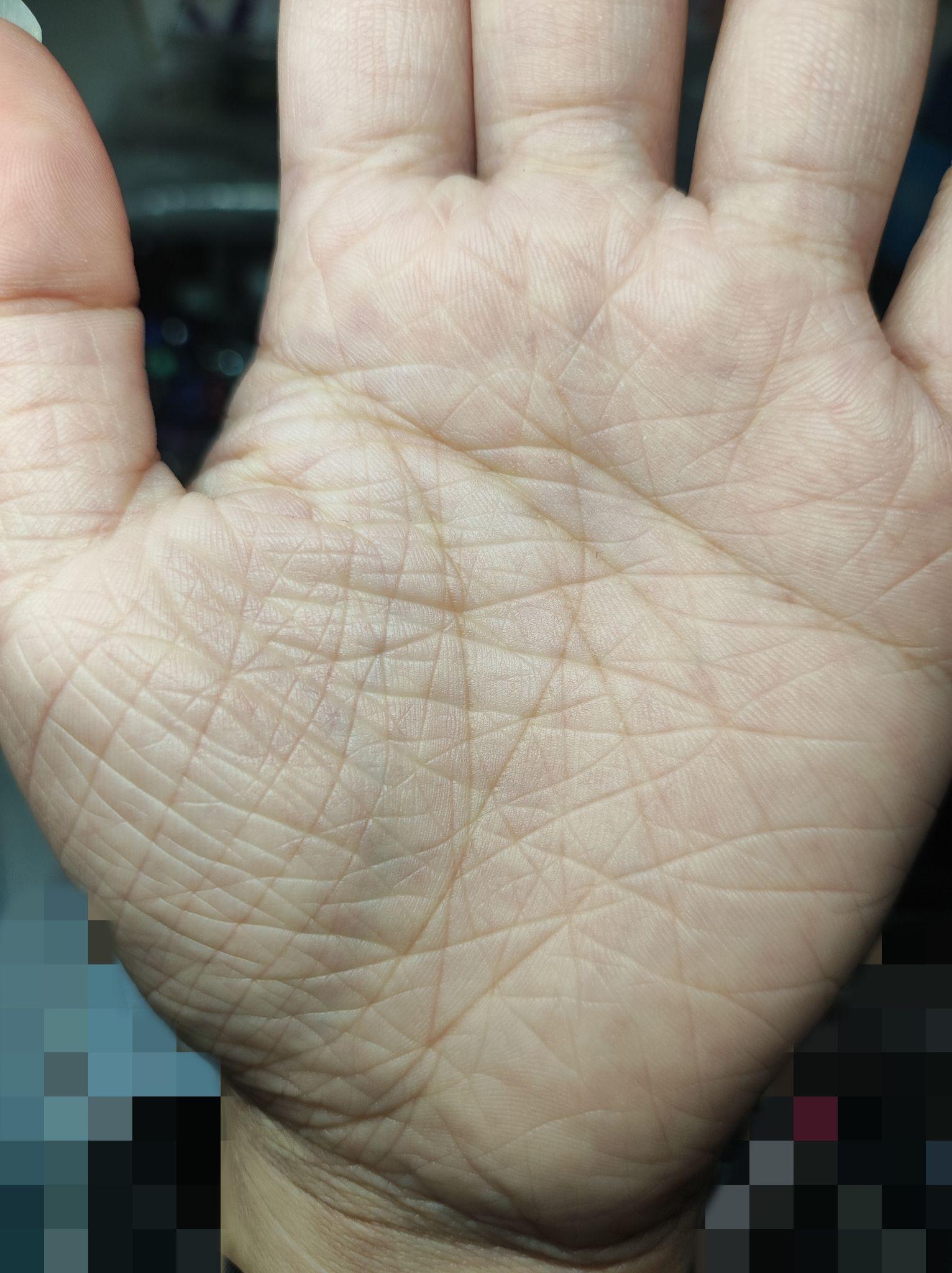 手掌天生粗糙纹路多 有希望解决吗? - 知乎