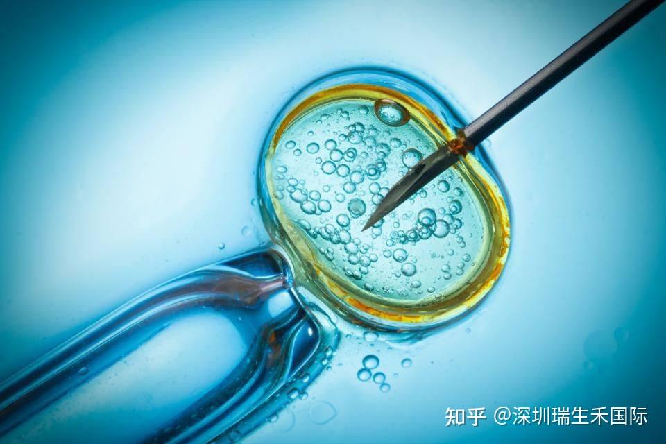 女士试管婴儿挂啥科(做试管婴儿挂号挂什么科)-第1张图片-鲸幼网