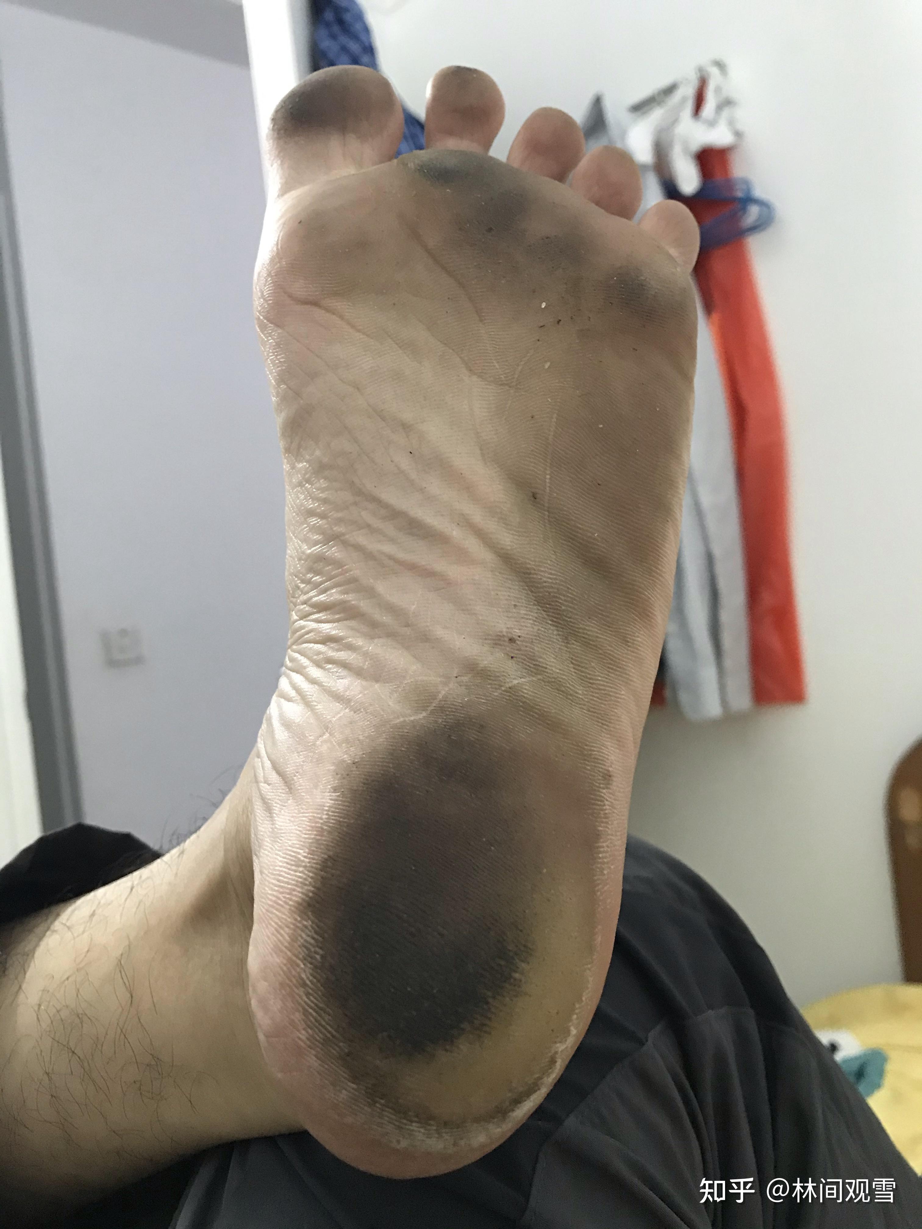 大学穿凉鞋会不会很奇怪