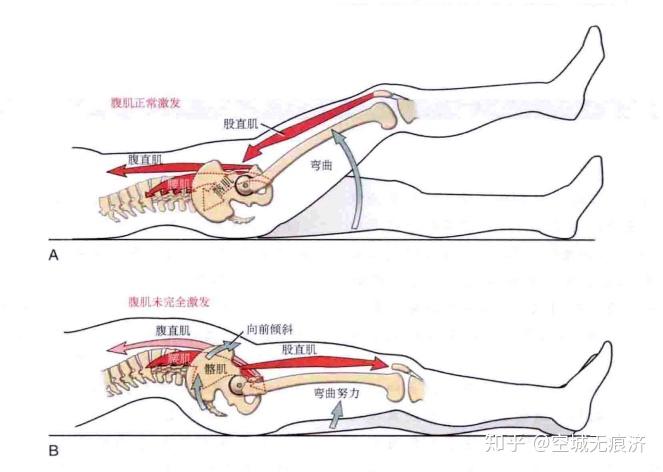 【运动康复知识22】肌肉之间的关系及代偿机制 - 知乎