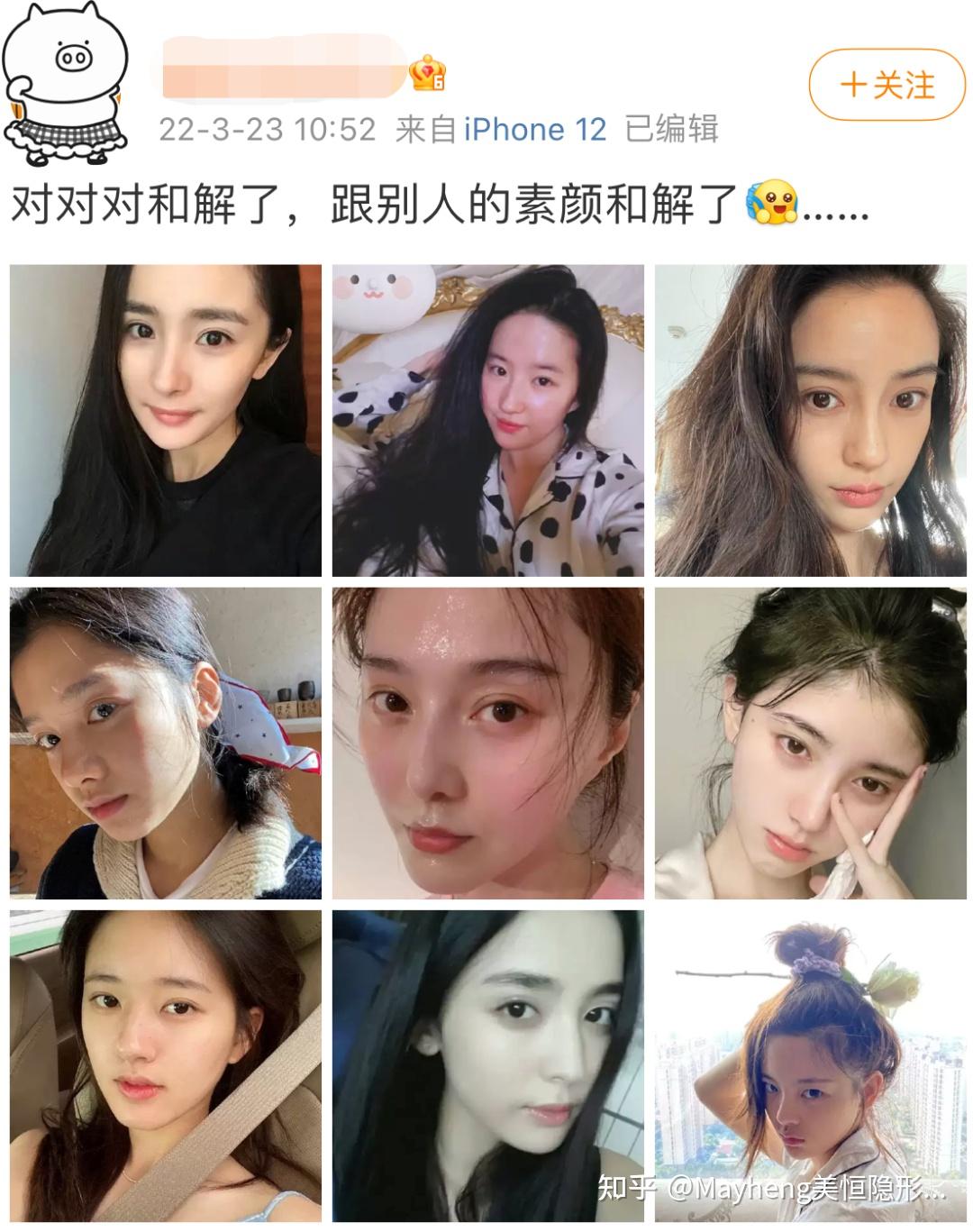 說換臉有些誇張,但是有些妹妹真的很適合整牙! - 知乎