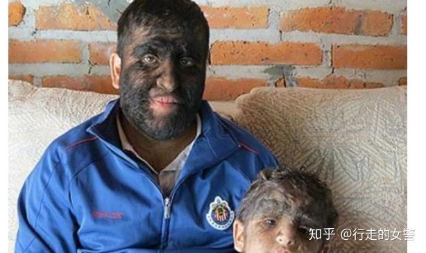 你身上或者你身边人有哪些返祖现象