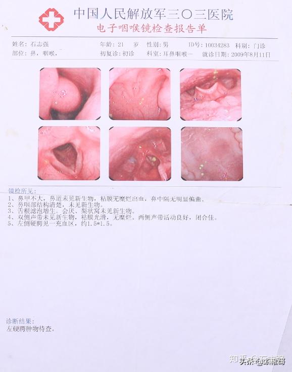 咽喉炎病历图片