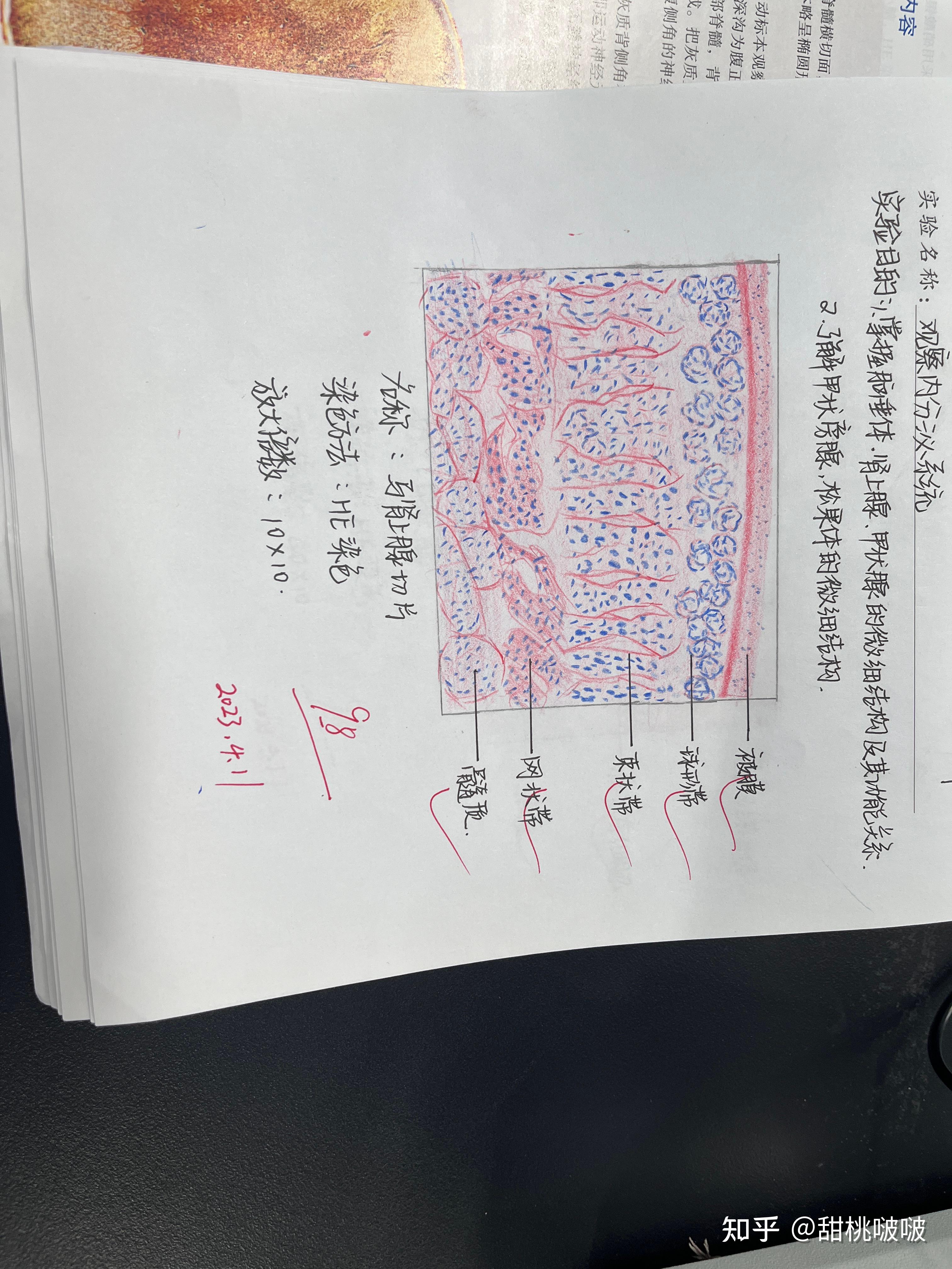 甲状腺切片手绘图图片