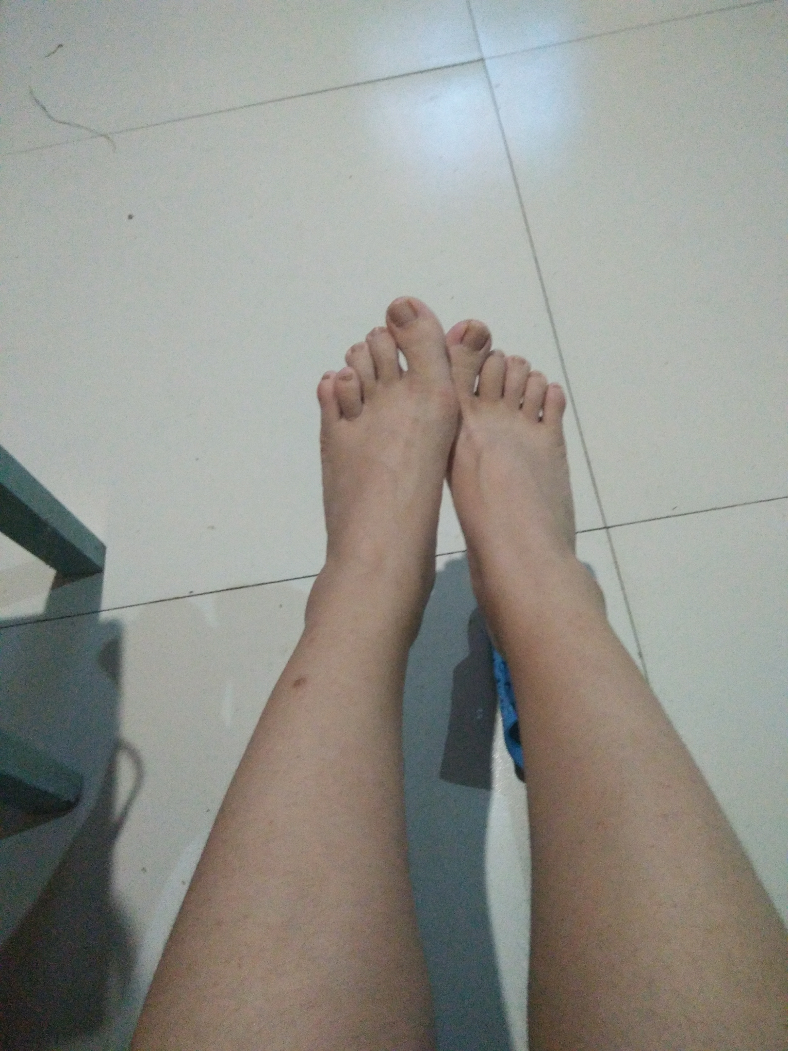 你们会介意女孩子脚趾畸形么? - 知乎