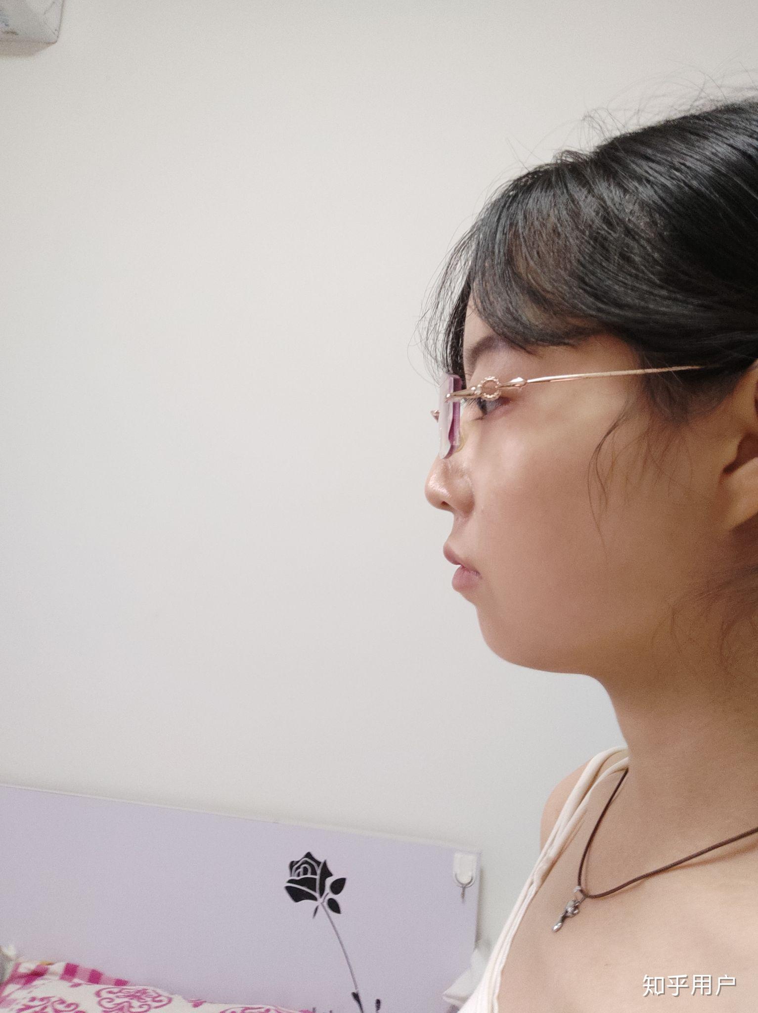 如果门牙突出经常按压能有效果吗