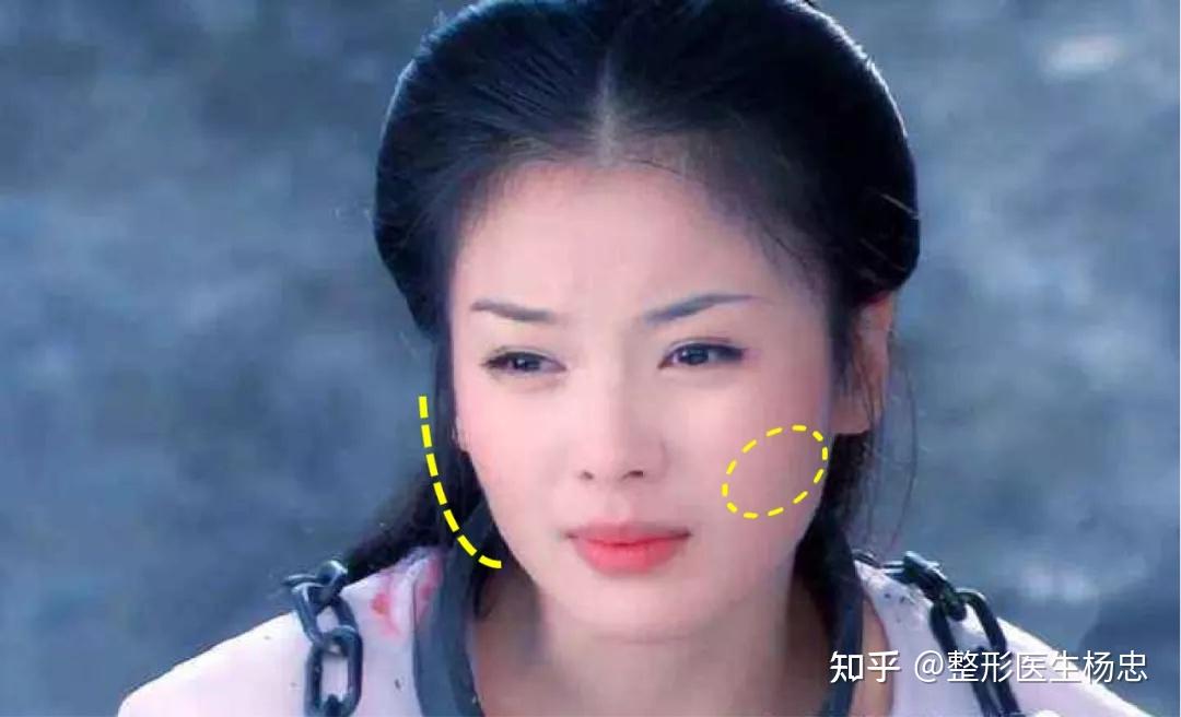 为什么刘涛的脸忽然就陷下去了