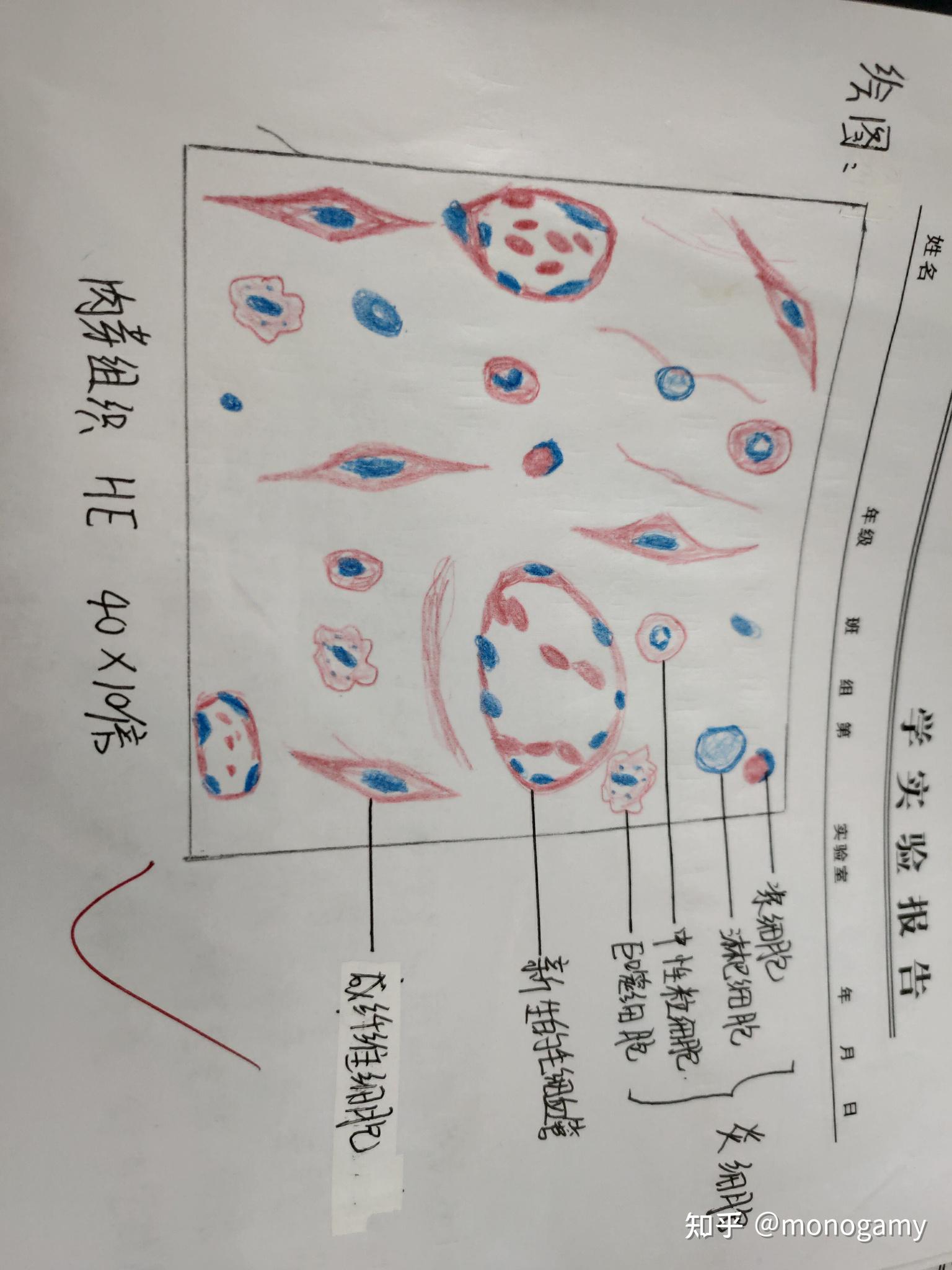 炎性肉芽组织红蓝铅笔图片