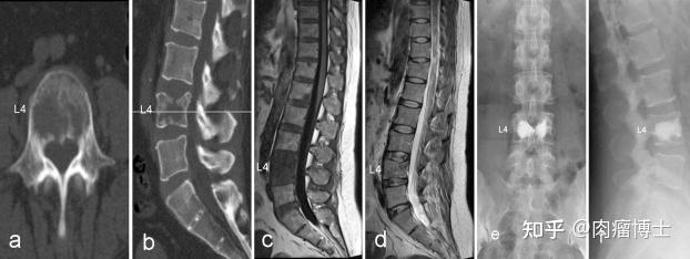 上海第十人民医院骨转移癌多学科联合门诊mdt门诊介绍