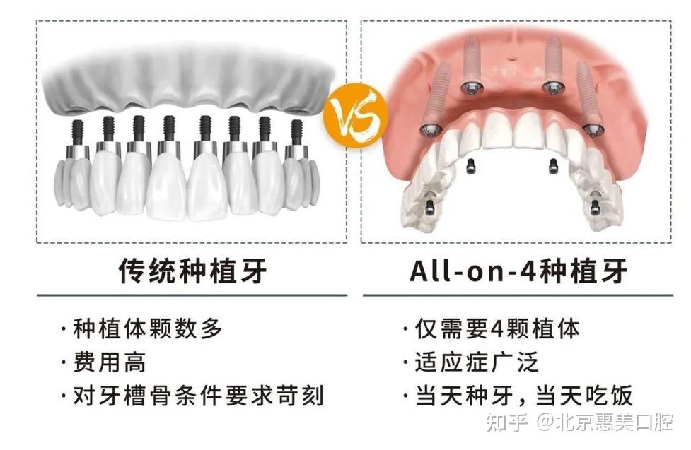 以及配用基臺情況.