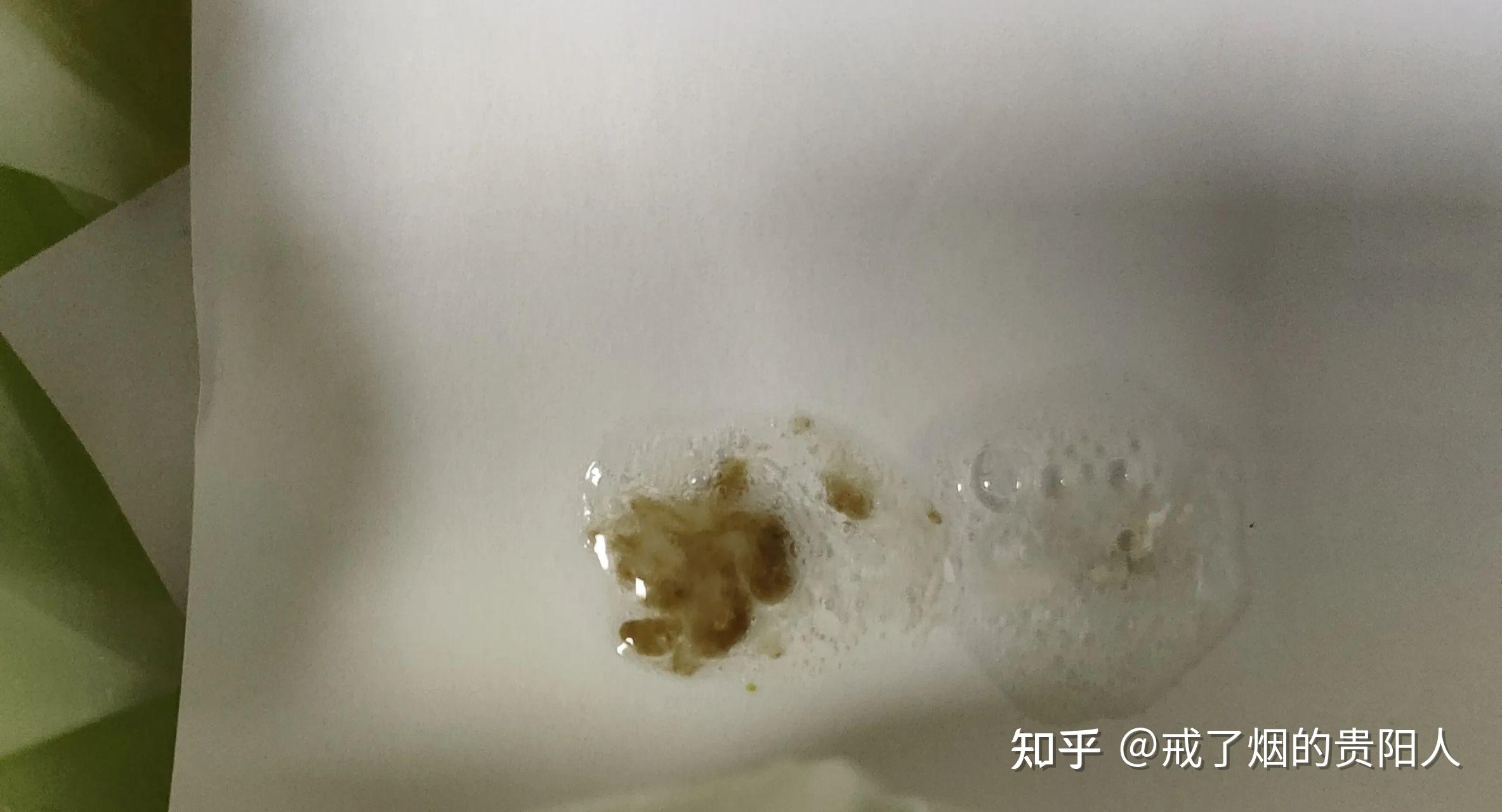 戒烟后吐出来的黑痰是什么物质