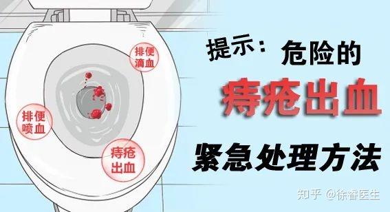 危险的痔疮出血，这里有紧急处理的方法