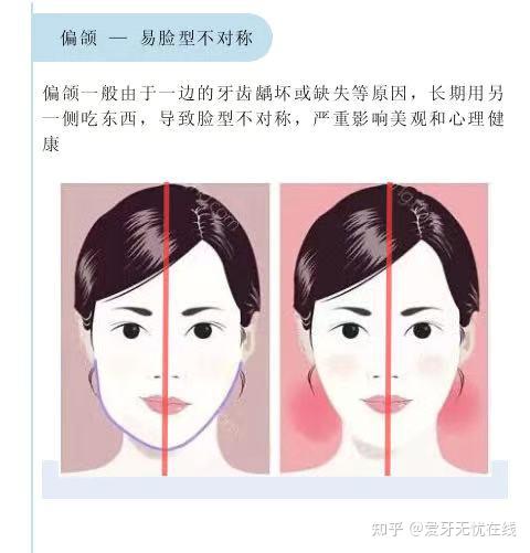 脸有点歪,要怎么矫正? - 知乎