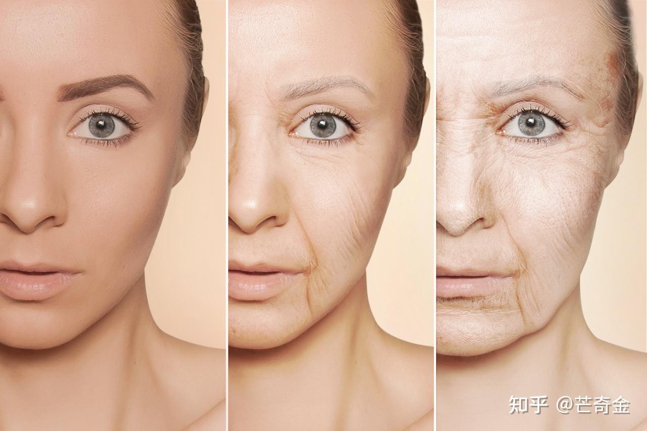 皮肤美白重要还是抗衰重要? - 知乎