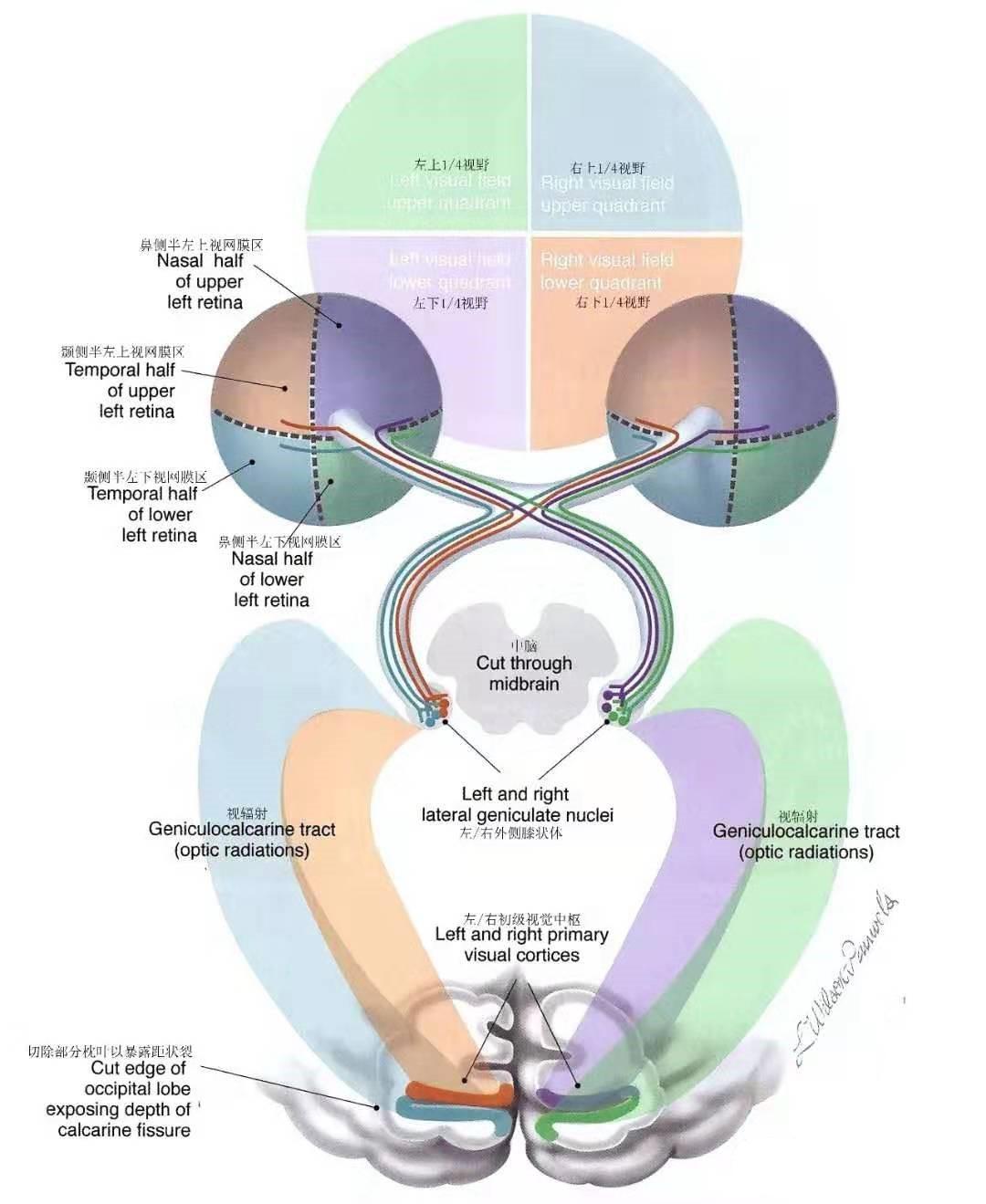 聚焦视辐射——侧脑室颞角和三角区相关手术入路的思考（上） - 脑医汇 - 神外资讯 - 神介资讯