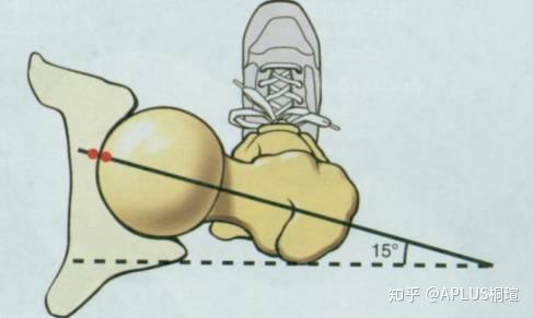 再来看下股骨与骨盆的前倾角从后面看:骶骨 : 男性为等腰三角形,女性