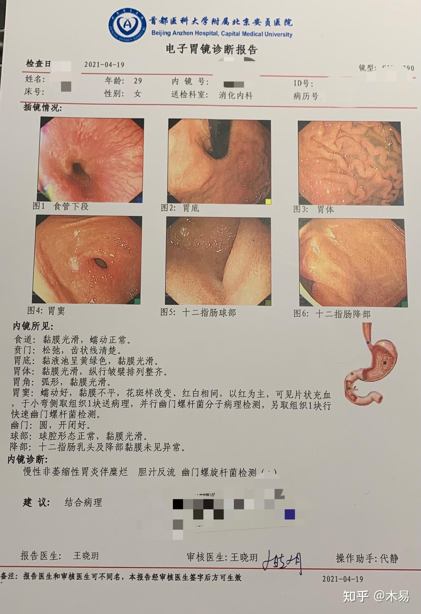 胃镜检查报告c13呼气实验报告内镜下dna探针检测幽门螺旋杆菌报告病理