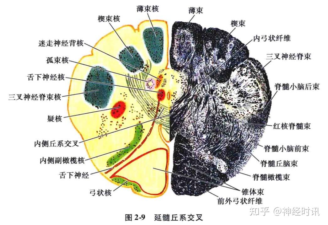 橄榄体解剖图片