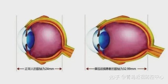 v2-2d5d30a252a3ecc39d11764d4d7c76a8_r.jpg