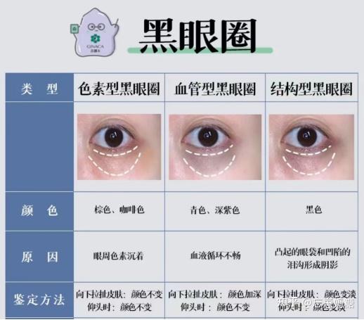 黑眼圈颜色分类图片