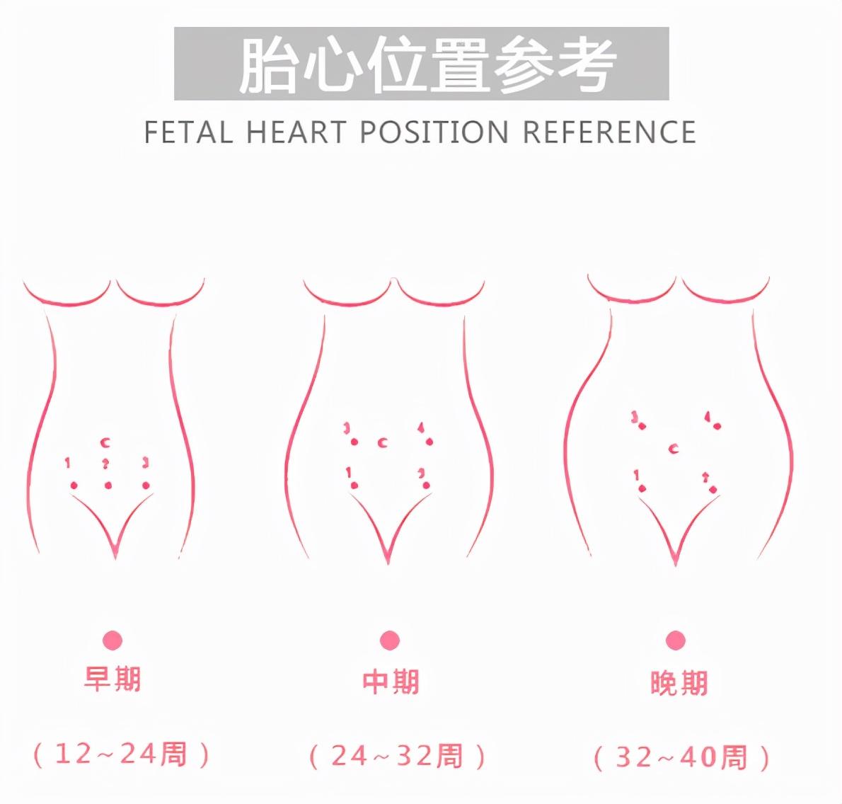 孕5月胎心位置示意图图片