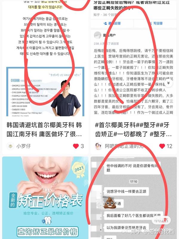 正直 的牙科 韩国牙科扒皮 大坑慎入 知乎
