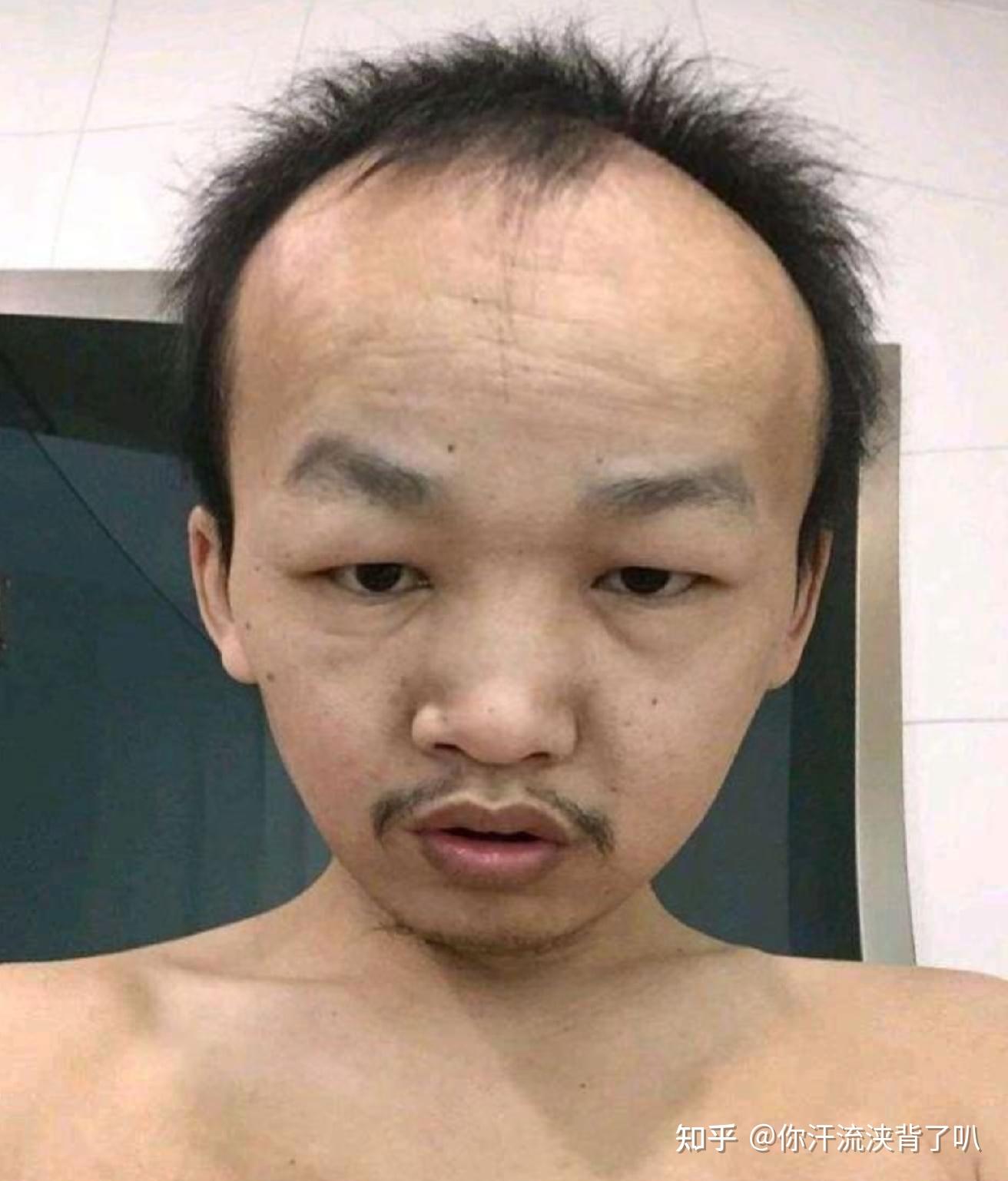 有没有长得丑的男生照片分享一下我想知道什么样算丑