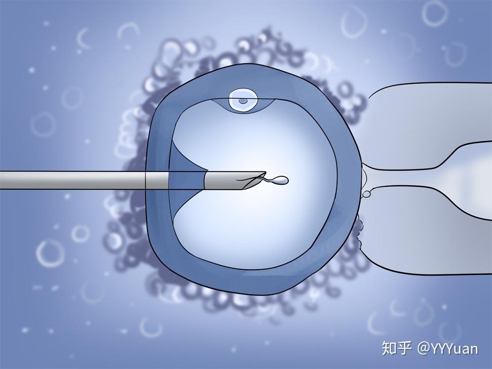 试管婴儿智商普遍不高知乎(请问试管婴儿的孩子会出现智商低的情况吗?)-第1张图片-鲸幼网