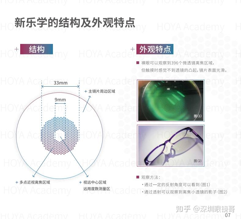 孩子配了豪雅光学的新乐学镜片控制近视度数但这个镜片上面有一圈小点