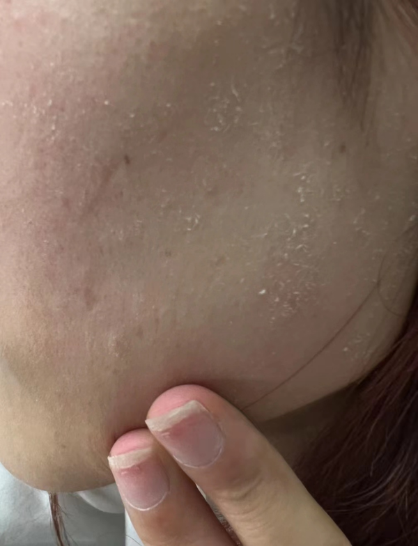 皮肤缺水,粗糙无光泽,有没有适合干皮的护肤品推荐?