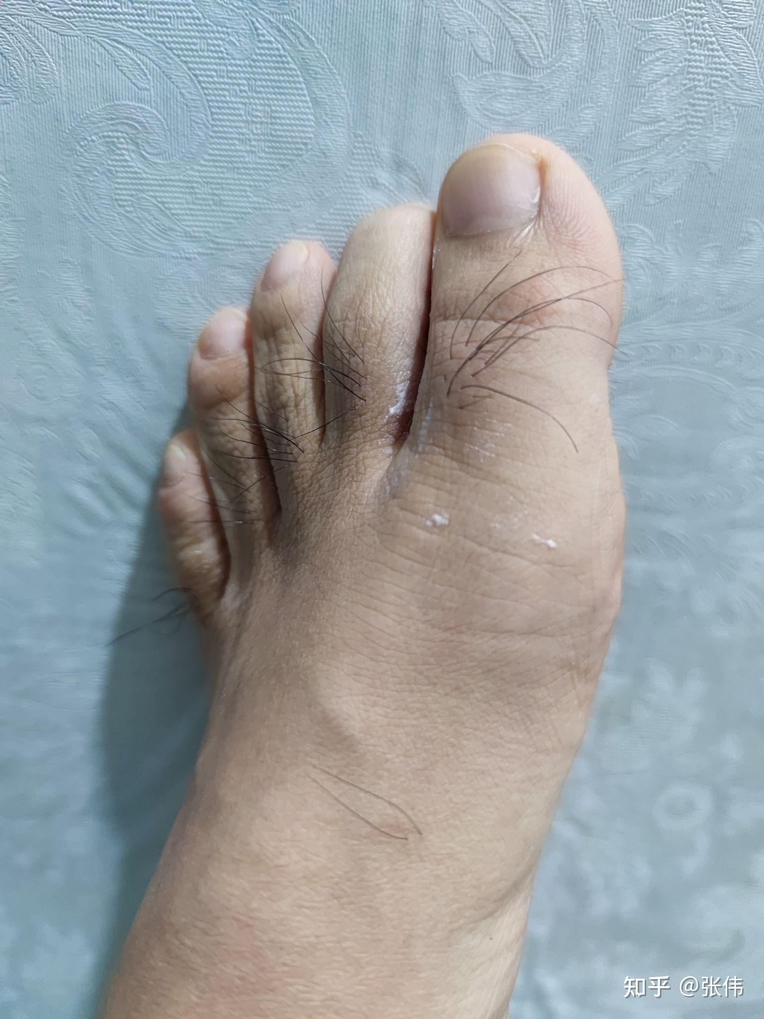 这个脚毛你们有吗