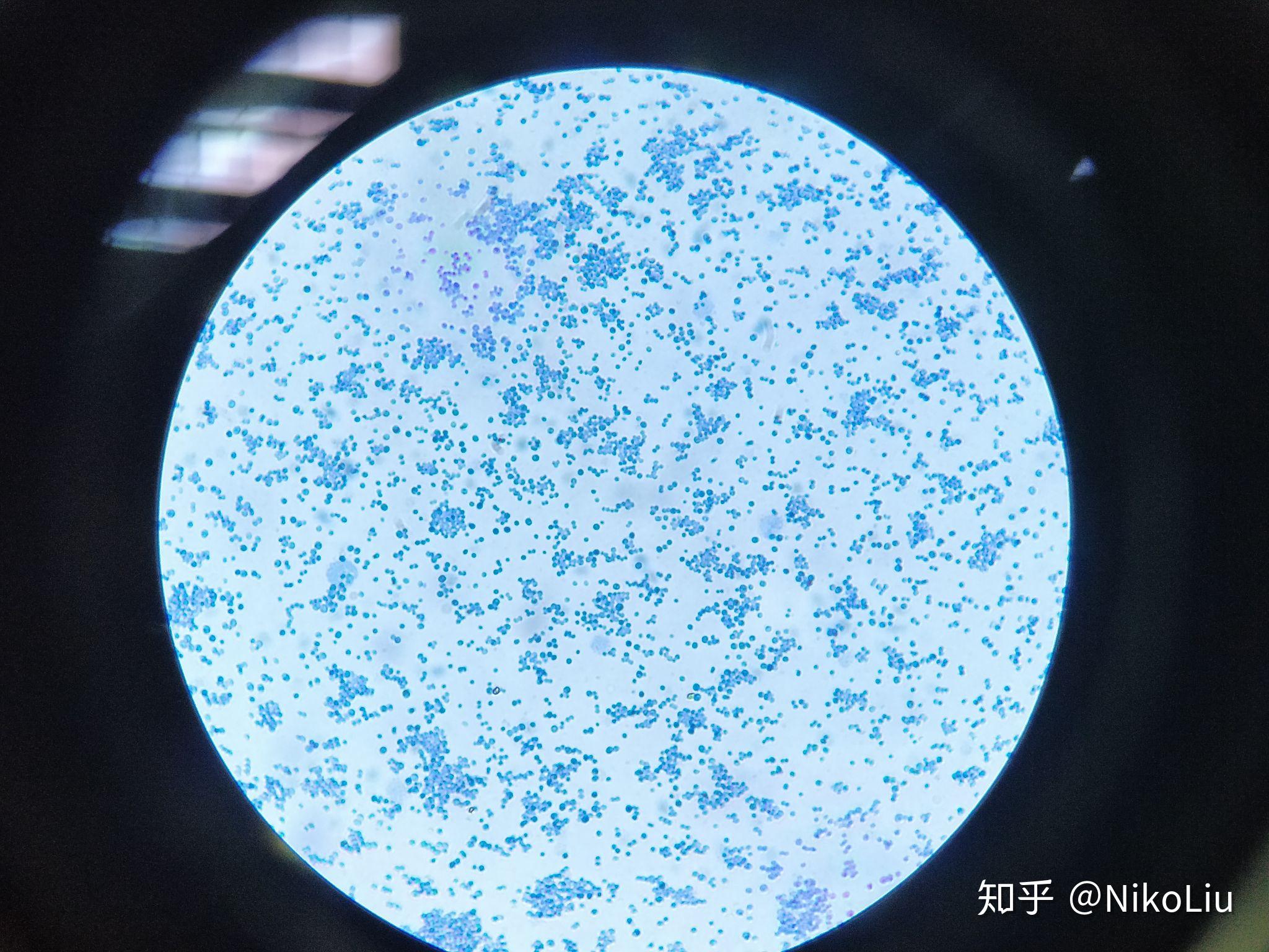 常见细菌可以用普通光学显微镜看到吗