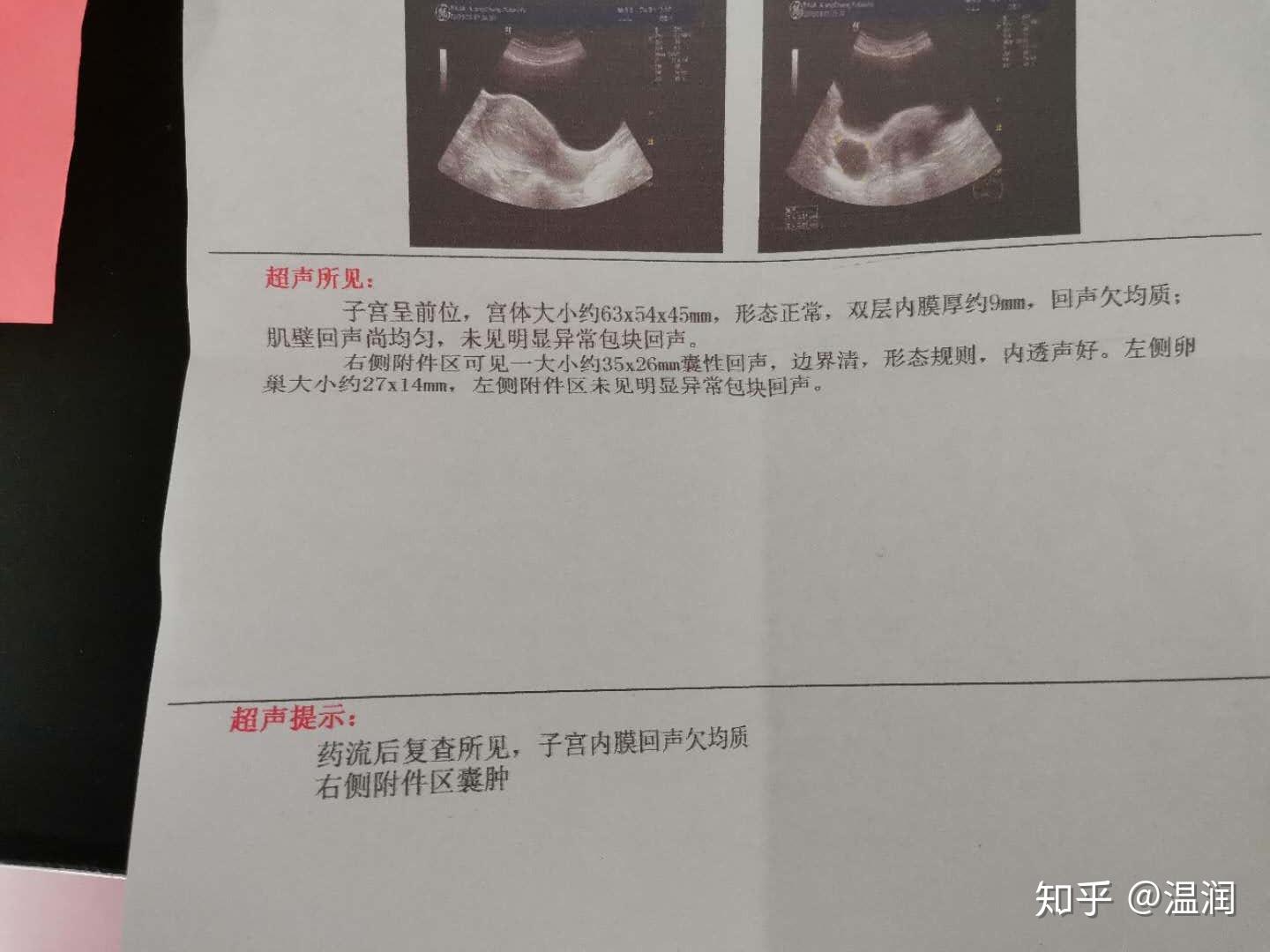 这还被说便宜吗？现在普通幼儿园到底多少钱一个月啊……我为什么给孩子选750块钱一个月的幼儿园？-全嘻嘻-全嘻嘻-哔哩哔哩视频