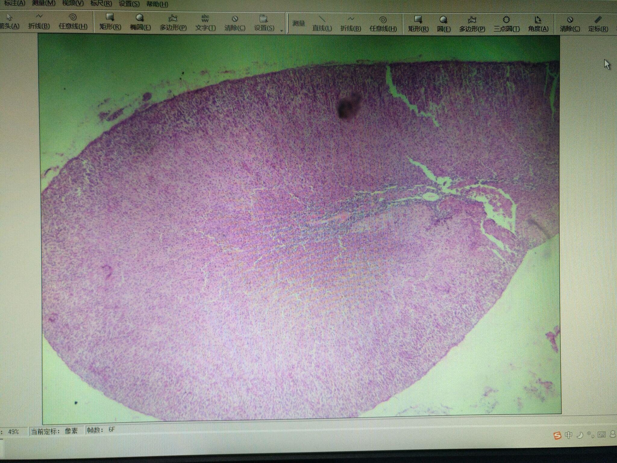 我是一名北京高二的学生将来想学医还想再学个