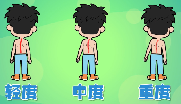 【少儿体态】青少年不良体态姿势认知(家长篇) - 知乎