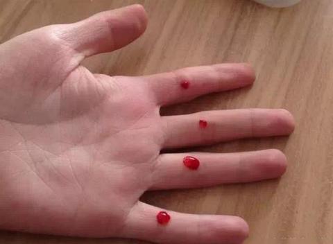 每次这样,我妈就会带我去找那个全身中药味的老头,拿针扎你手指,扎过