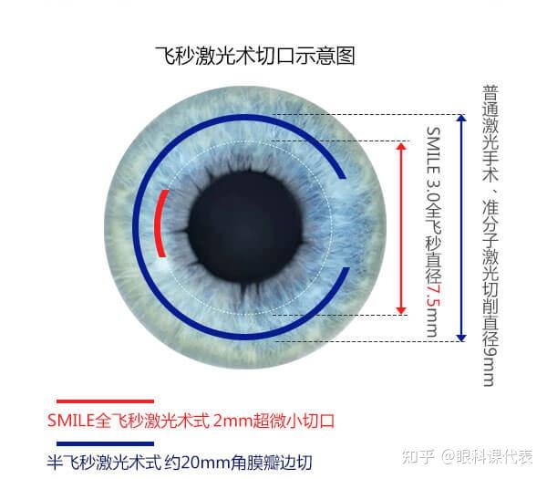 什么是飞秒和半飞秒 v2-2e9160497c289b706487ed40473d865c_r.jpg