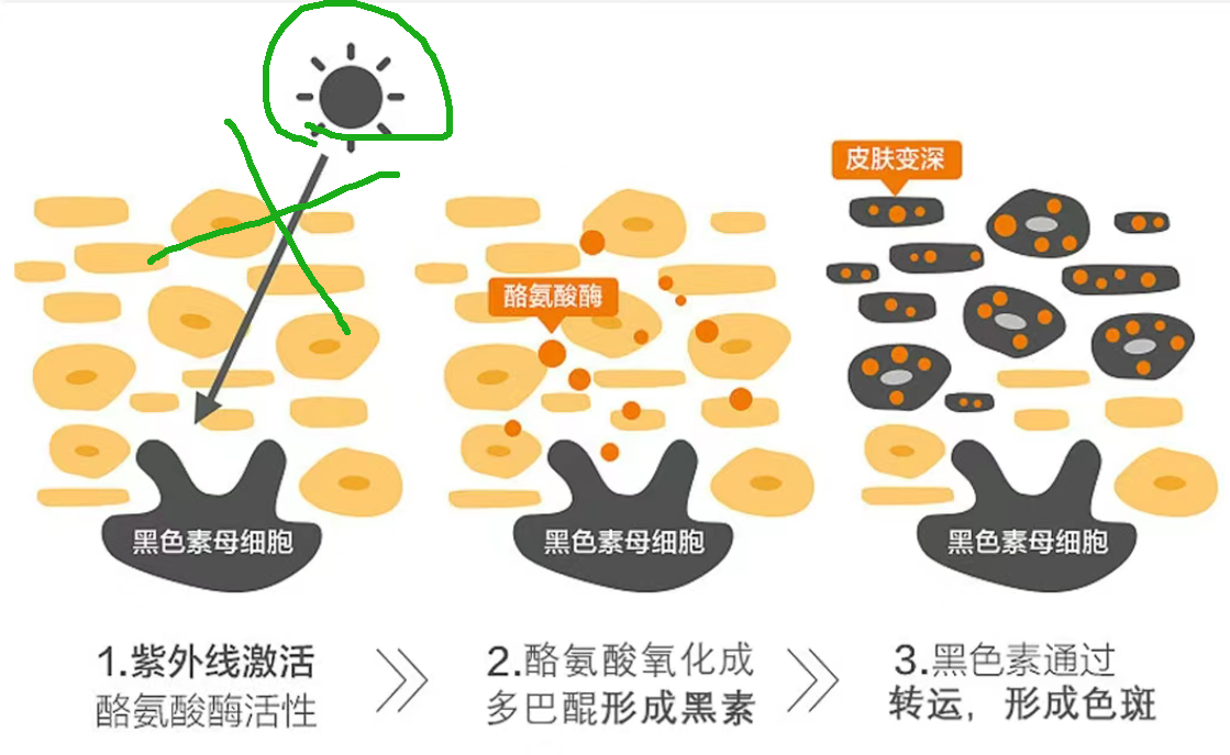 三甲皮肤医生1v1教你去除『黄褐斑』的方法