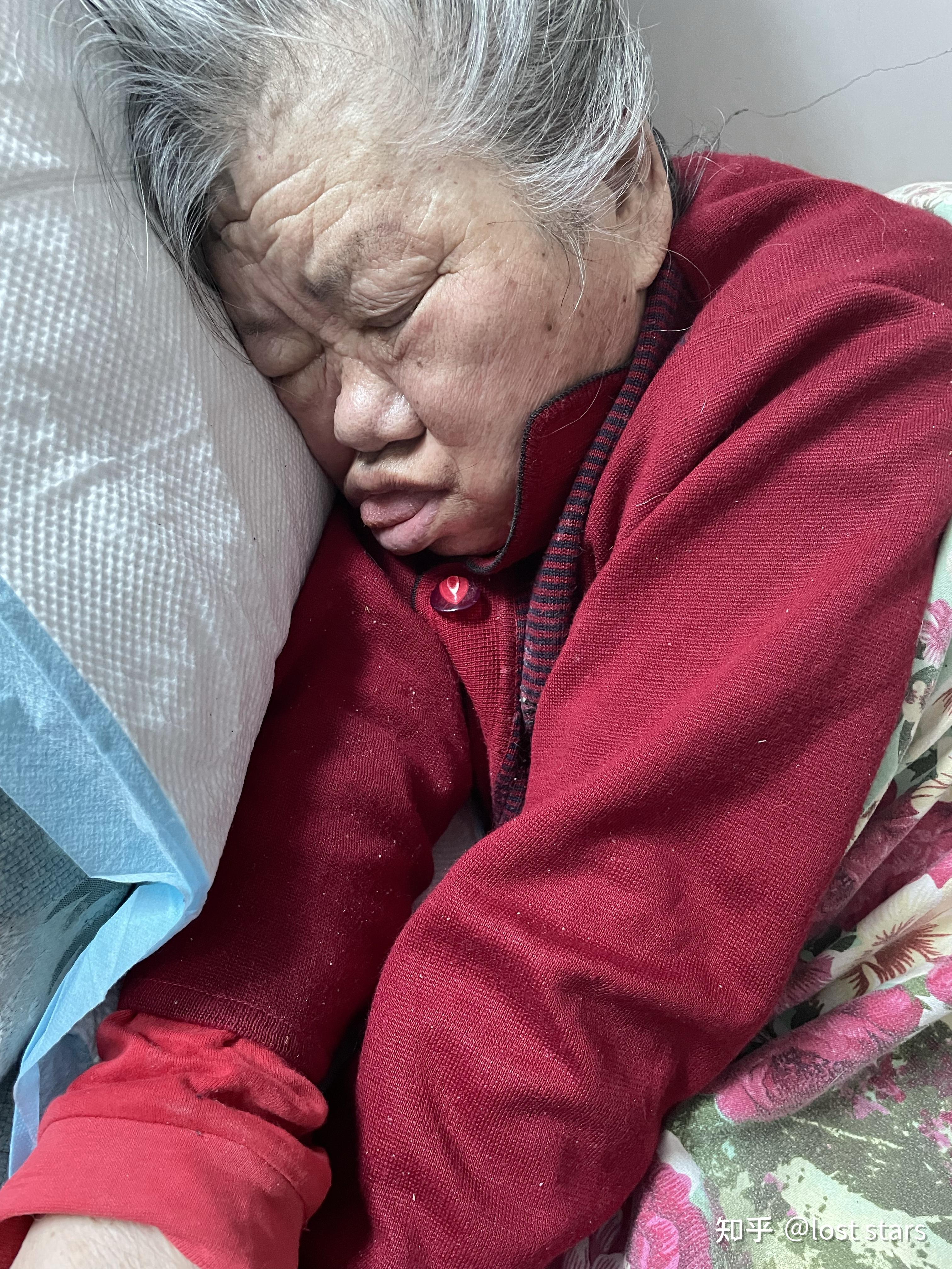 家里的老人生病了,什么心情? - 知乎