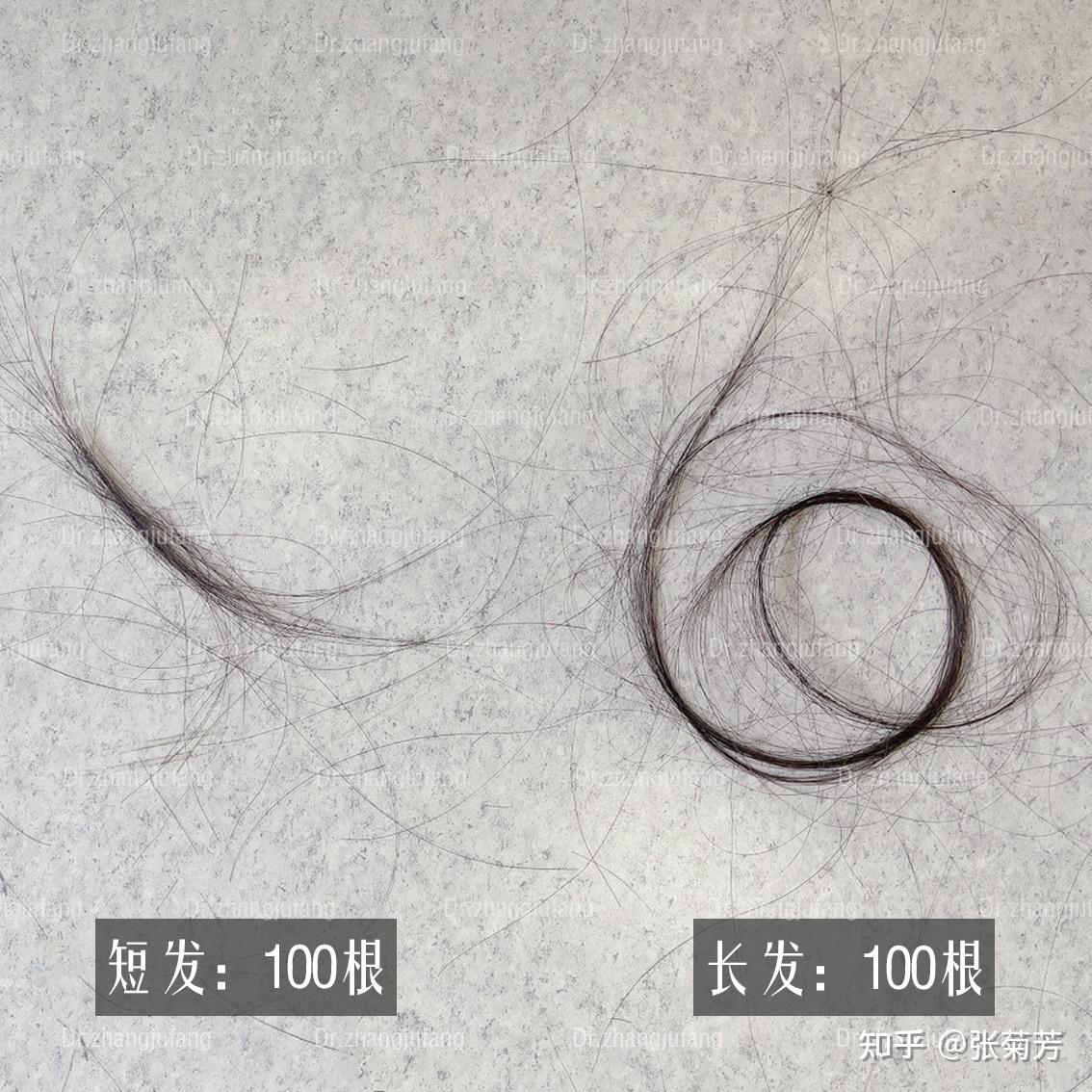 100根头发是多少? - 知乎