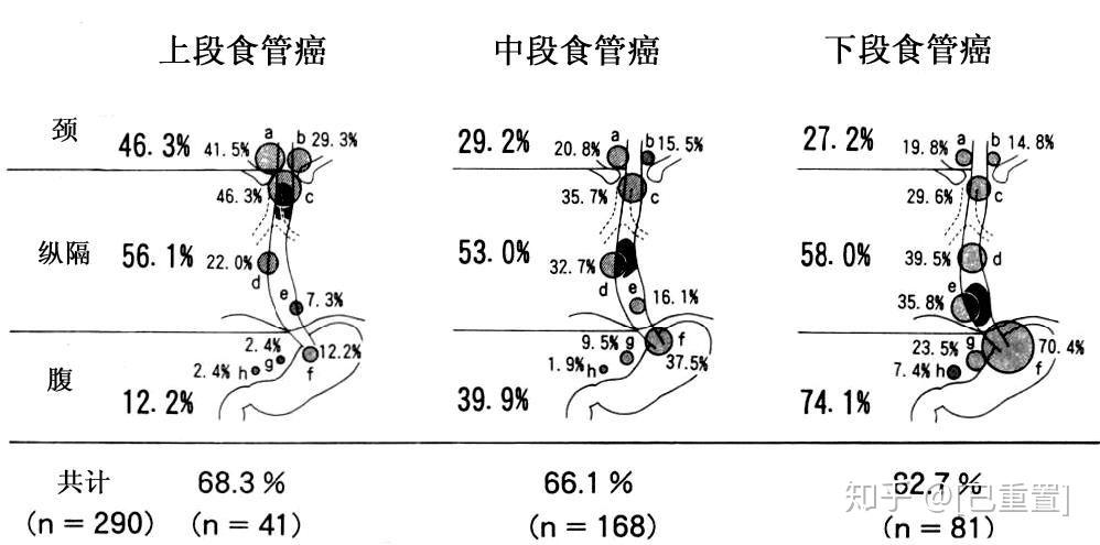 一文归纳食管癌放疗要点 - 知乎