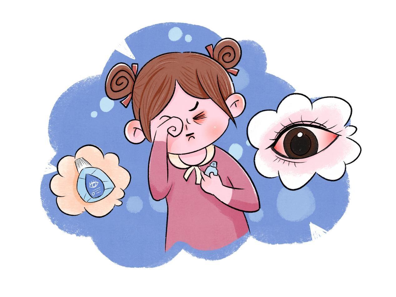 得了过敏性鼻炎,打喷嚏流鼻涕就算了,为什么眼睛还会痒? - 知乎