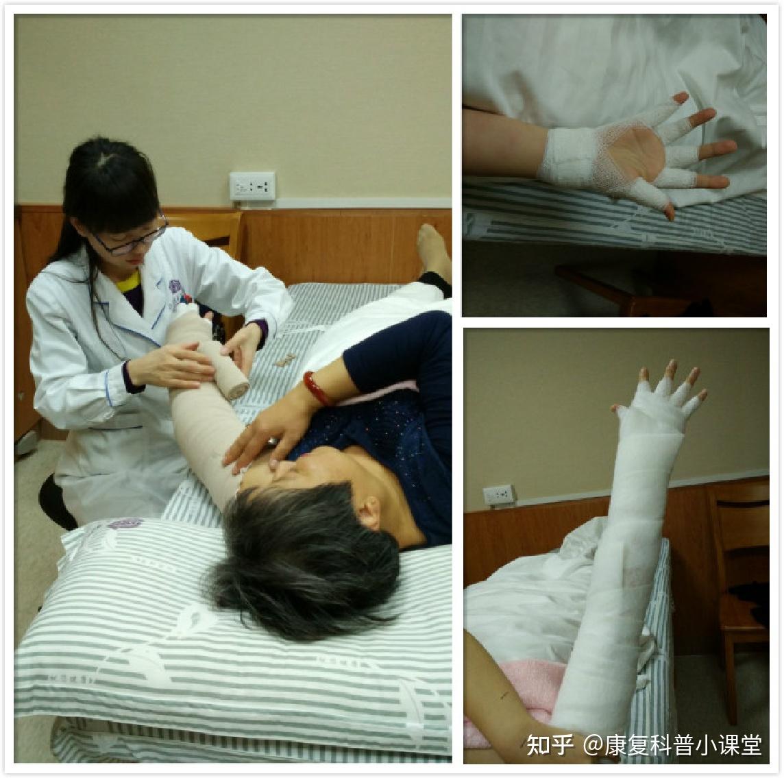 陕西省人民医院烧伤科患者正在使用医用浸浴治疗机_上海远铎医疗科技有限公司