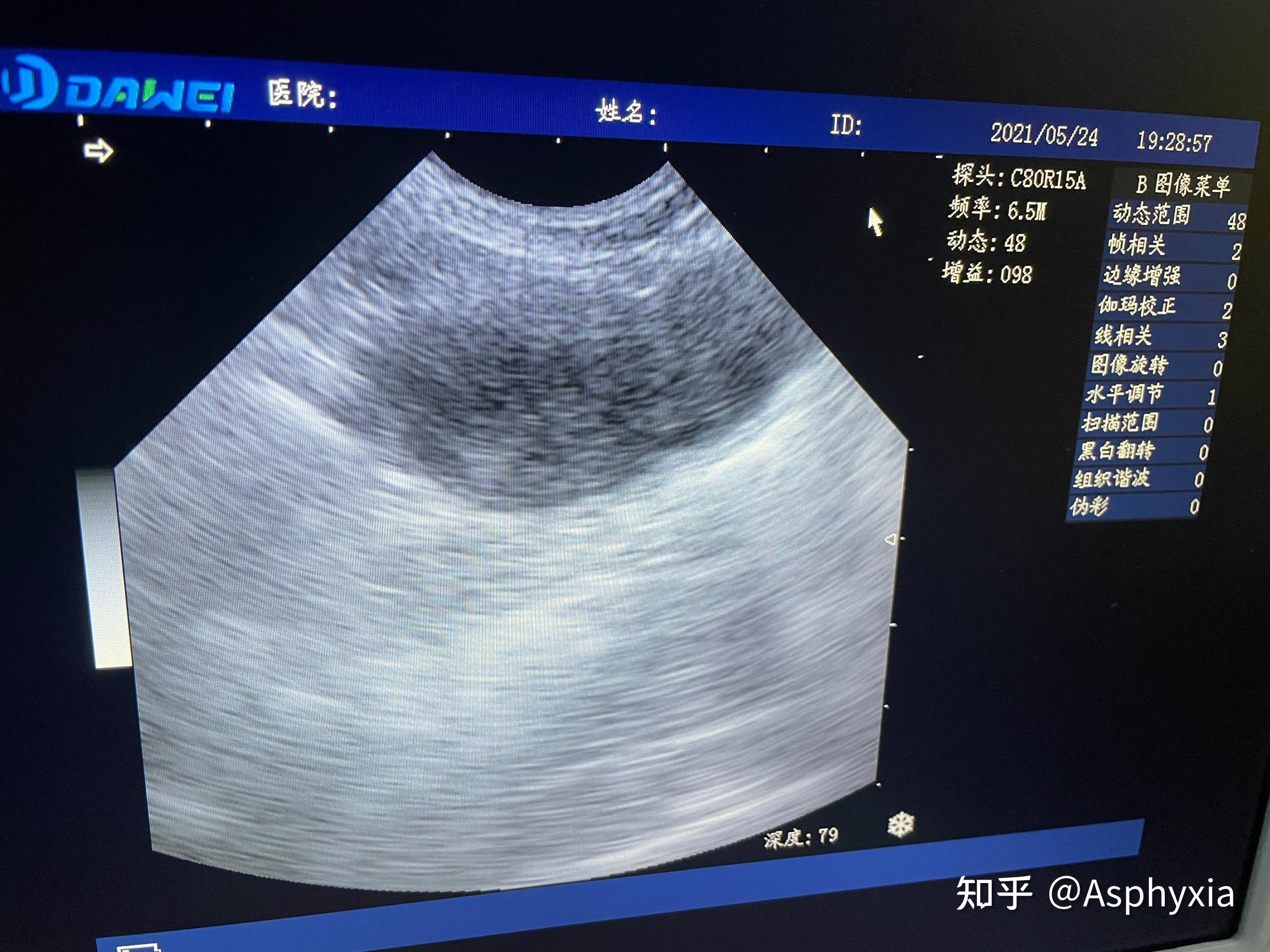 狗狗子宫蓄脓的治疗路
