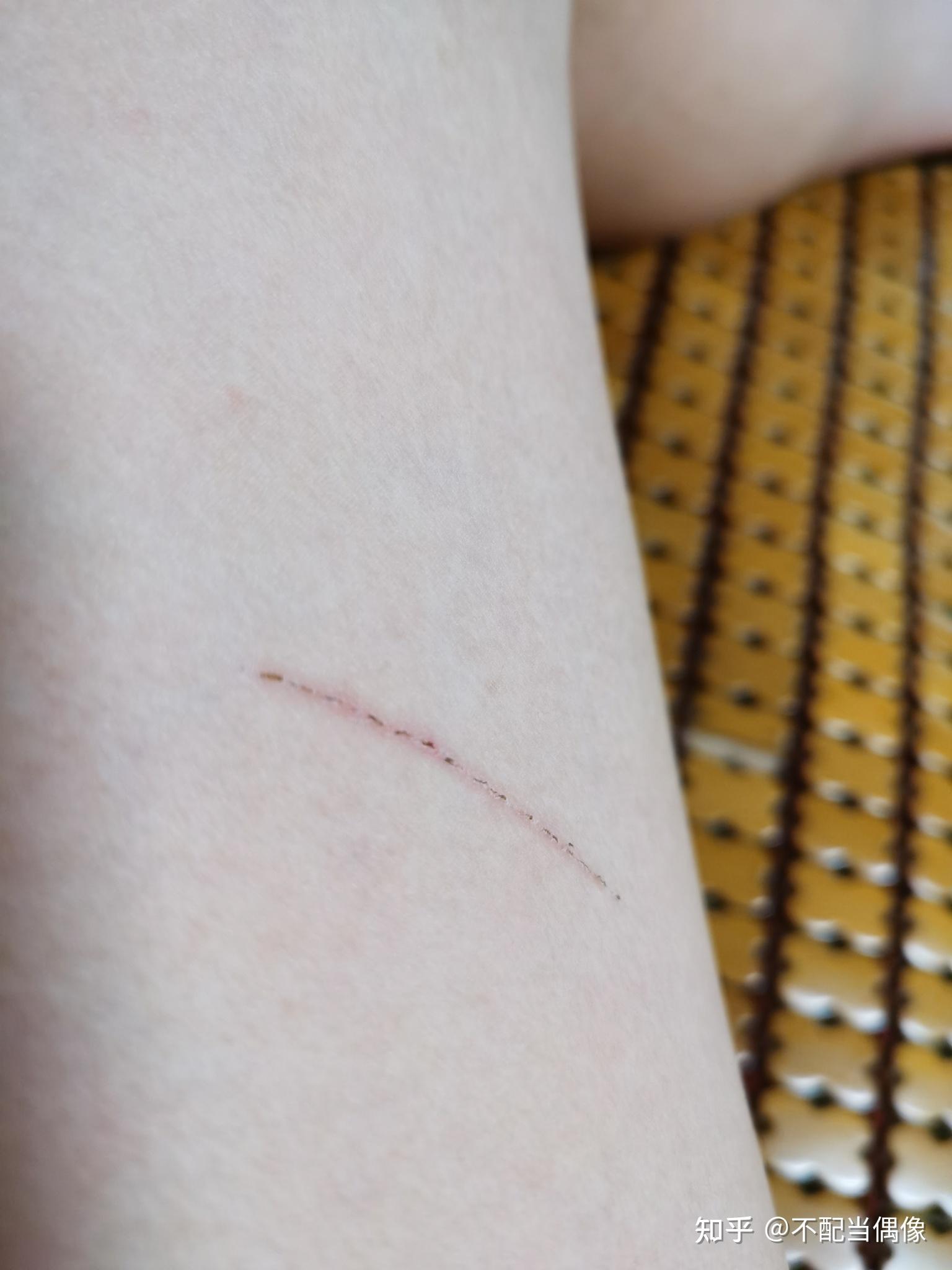 被别人养的猫抓伤我想要她付狂犬疫苗的钱不对吗