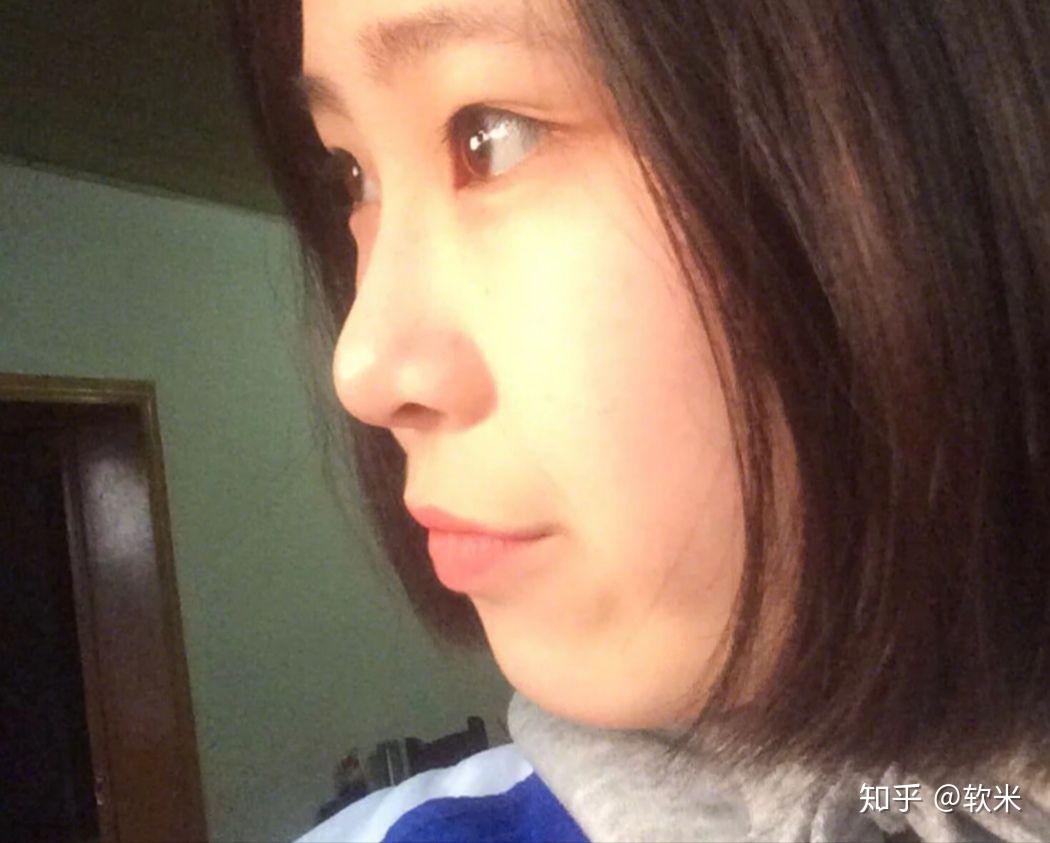 什么办法能让鼻梁变高 v2-2f8ef24cc0fc72be5282a42fb0c8bcfc_r.jpg