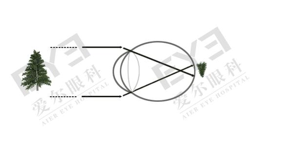 平行光線進入眼球后,途經角膜,晶狀體,玻璃體等等組織,經過一系列折射