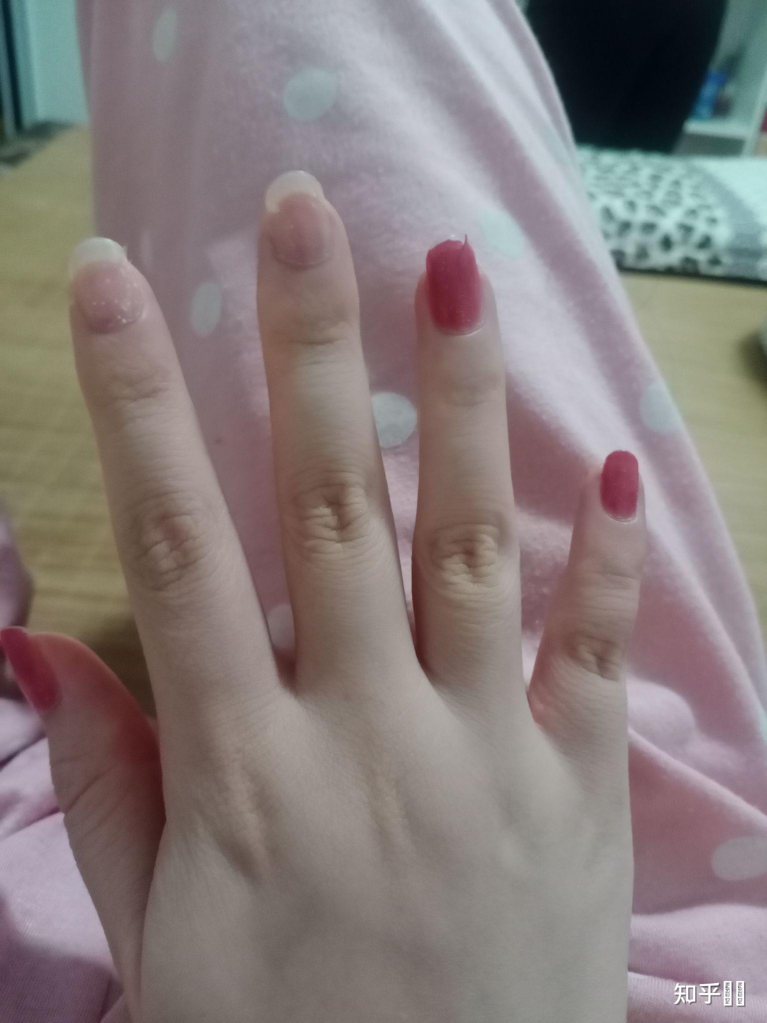 手指又粗又短是什么体验